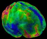 Variabilità della corteccia cerebrale