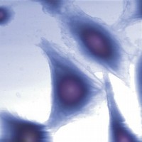 Cellule osservate con un microscopio a forza atomica