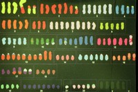 Mutazioni cromosomiche