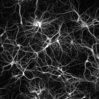 Struttura di neuroni