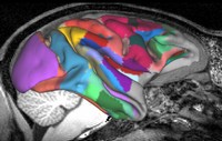 Aree della corteccia del macaco (vista laterale + MRI)