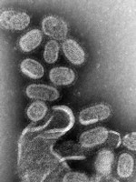 Il virus dell'influenza del 1918